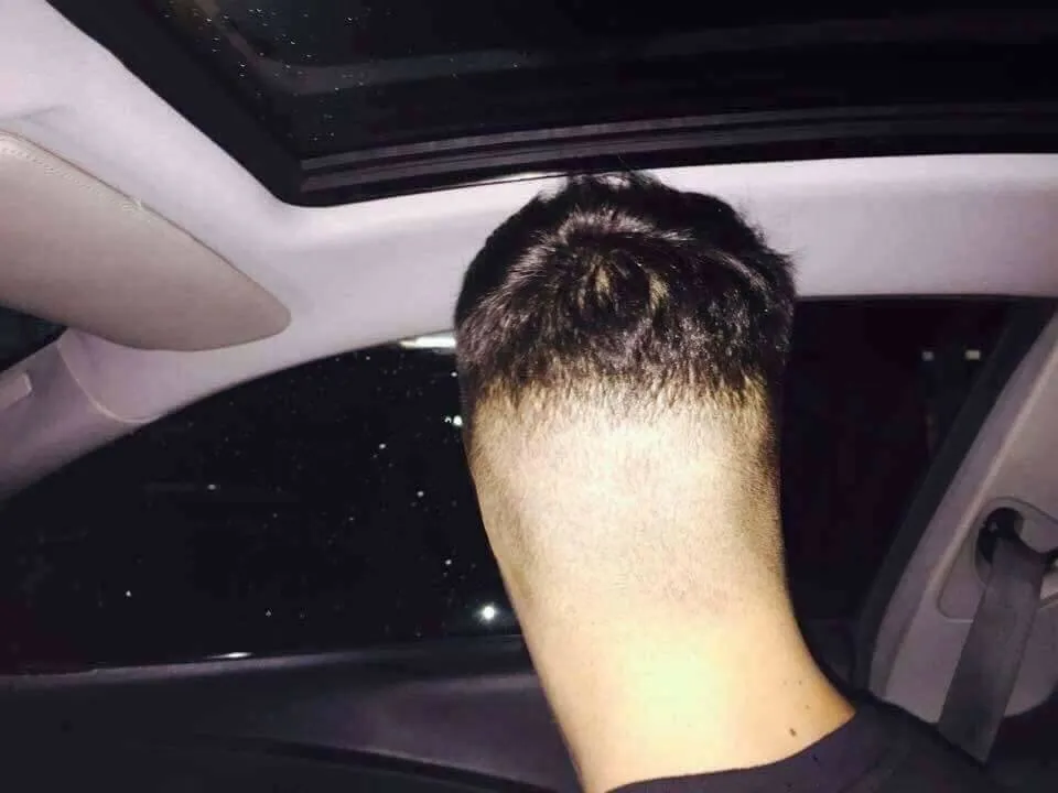 back of person's head that looks like thumb