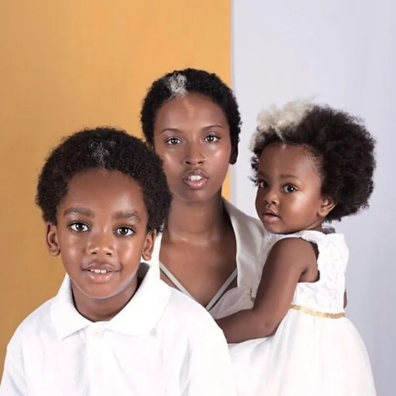 baby and mom born with same birth mark in hair