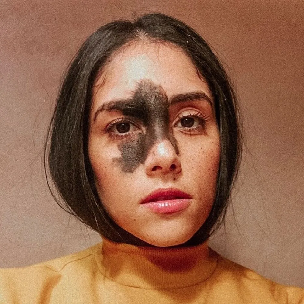 birthmark on brazilian model's face