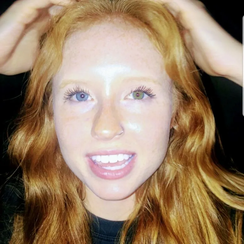 ginger with two different colored eyes