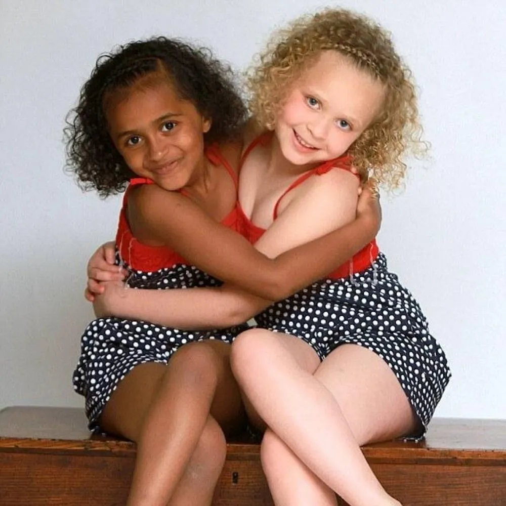 twins who were born different skin colors