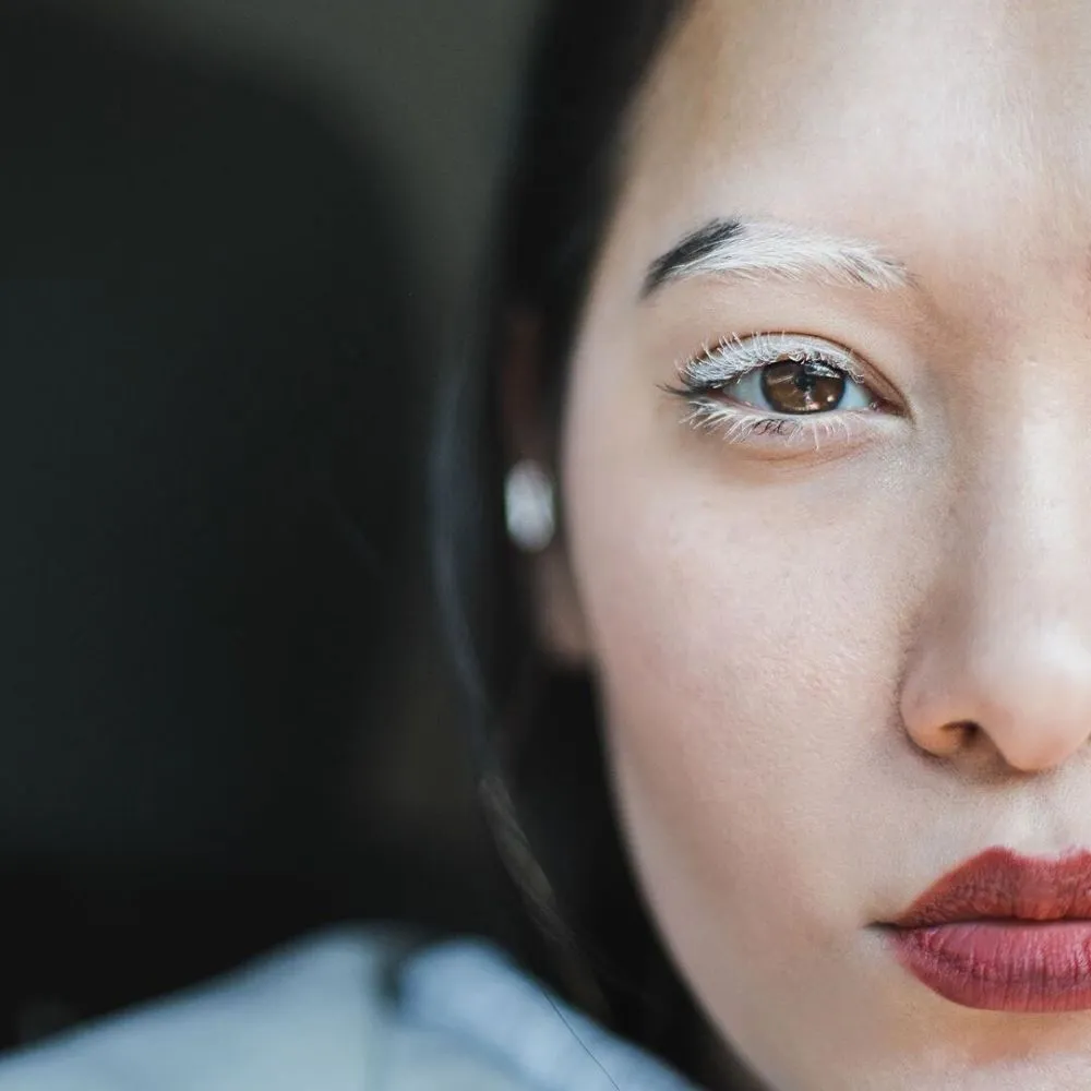 woman with vitiligo on eyebrows and eyelashes