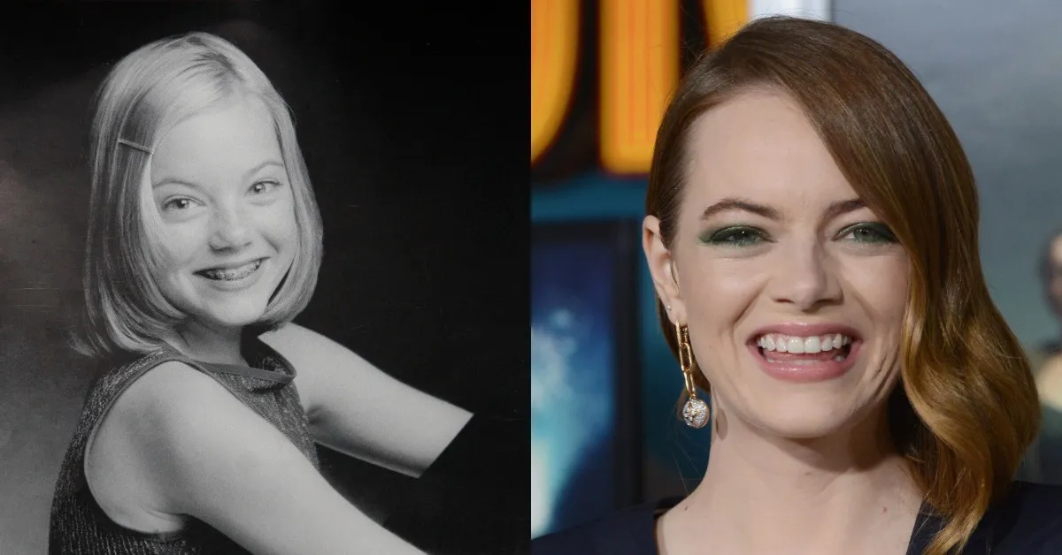 emma stone then vs now