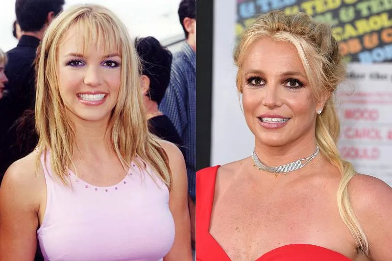 britney-spears-plastic-surgery