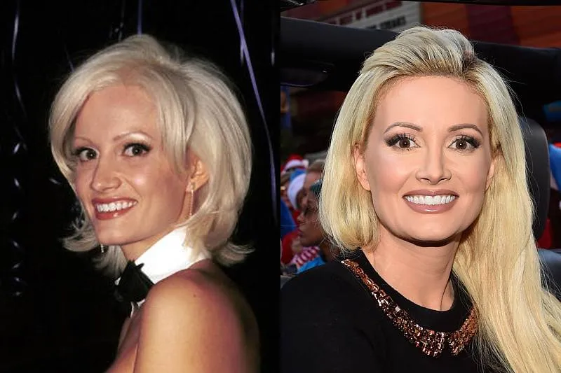 holly-madison-plastic-surgery